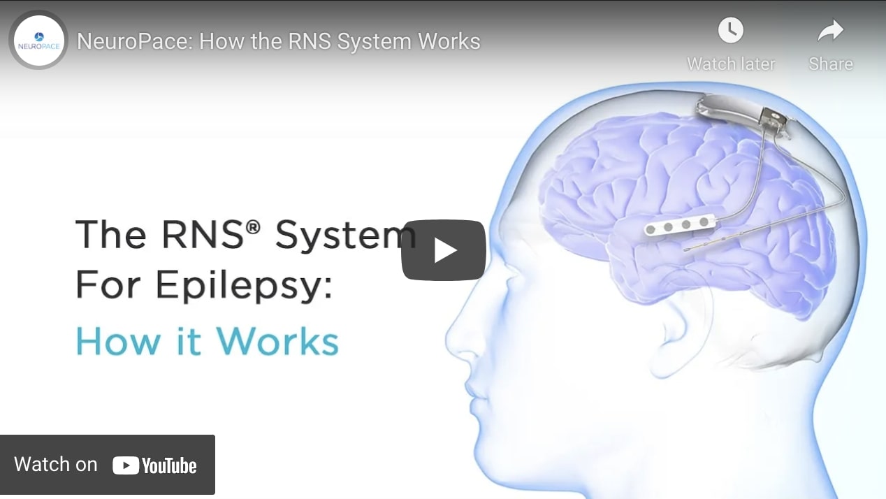 RNS System Intro