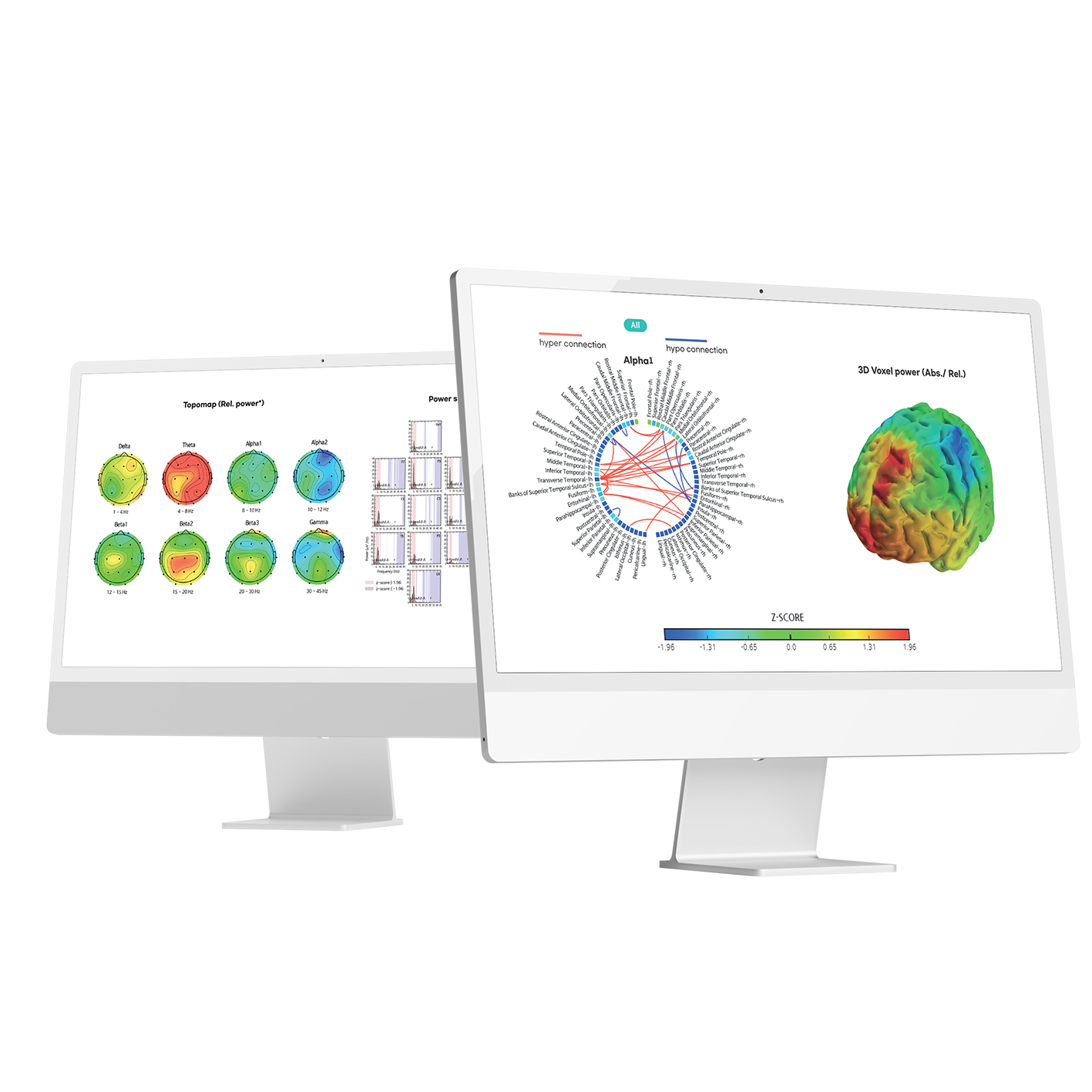 Image of eeg