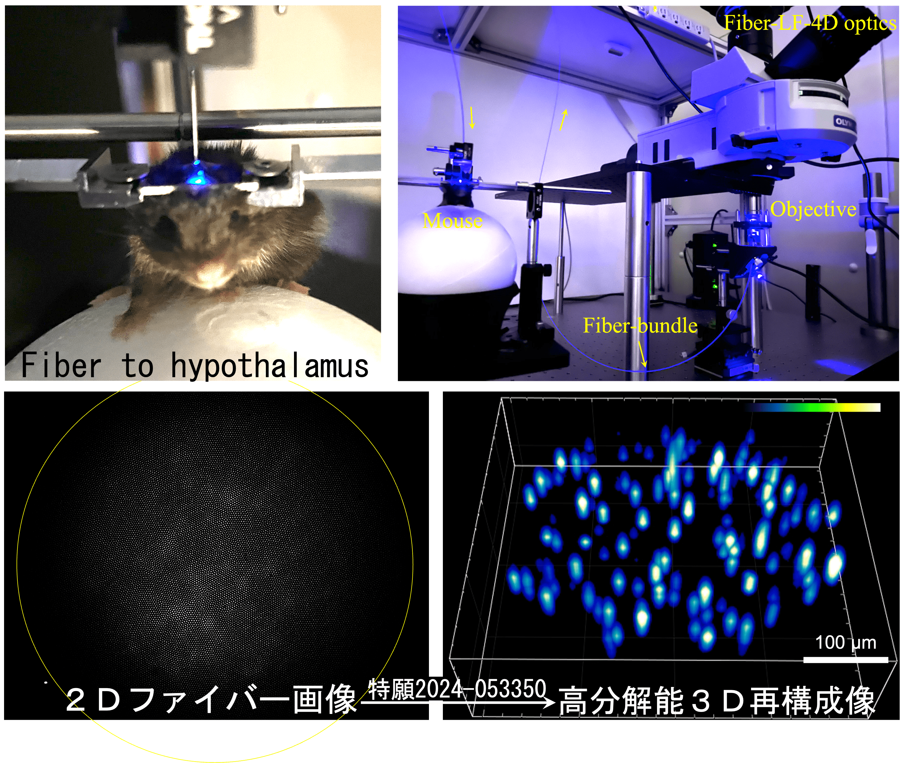 ライトフィールド型内視鏡をマウス視床下部に使用して得た画像